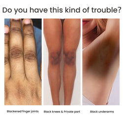 Image of Women's Skin Pigmentation Care